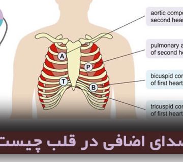 صدای اضافی در قلب چیست؟