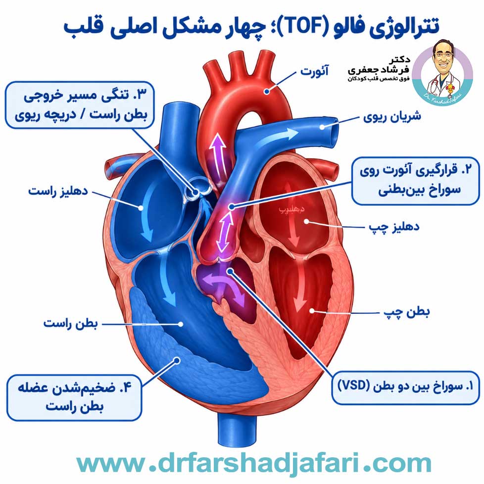 تترالوژی فالو