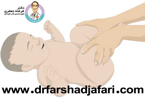 تترالوژی فالو در کودکان دکتر فرشاد جعفری